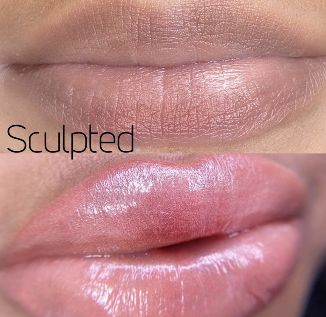 The Ultimate Lips Training Package (IN-PERSON)
